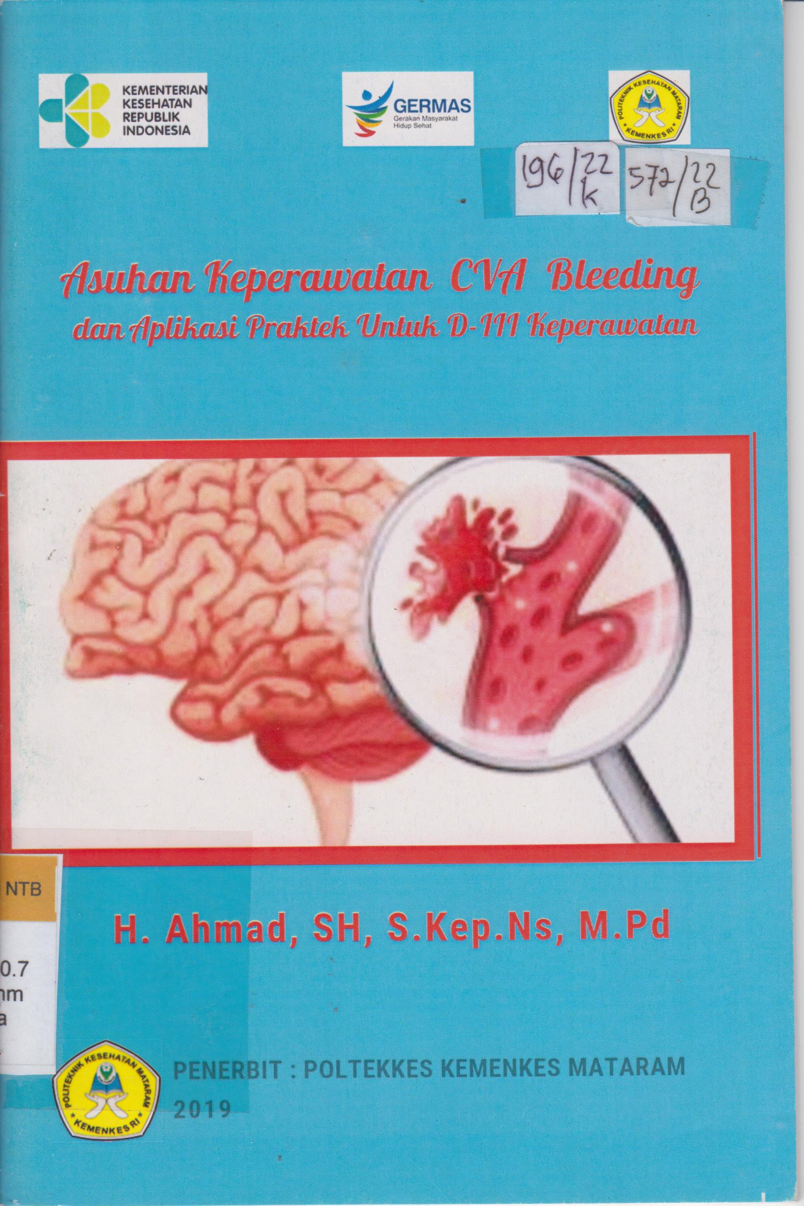 Cover Asuhan keperawatan CVA bleeding dan aplikasi praktek untuk DIII keperawatan