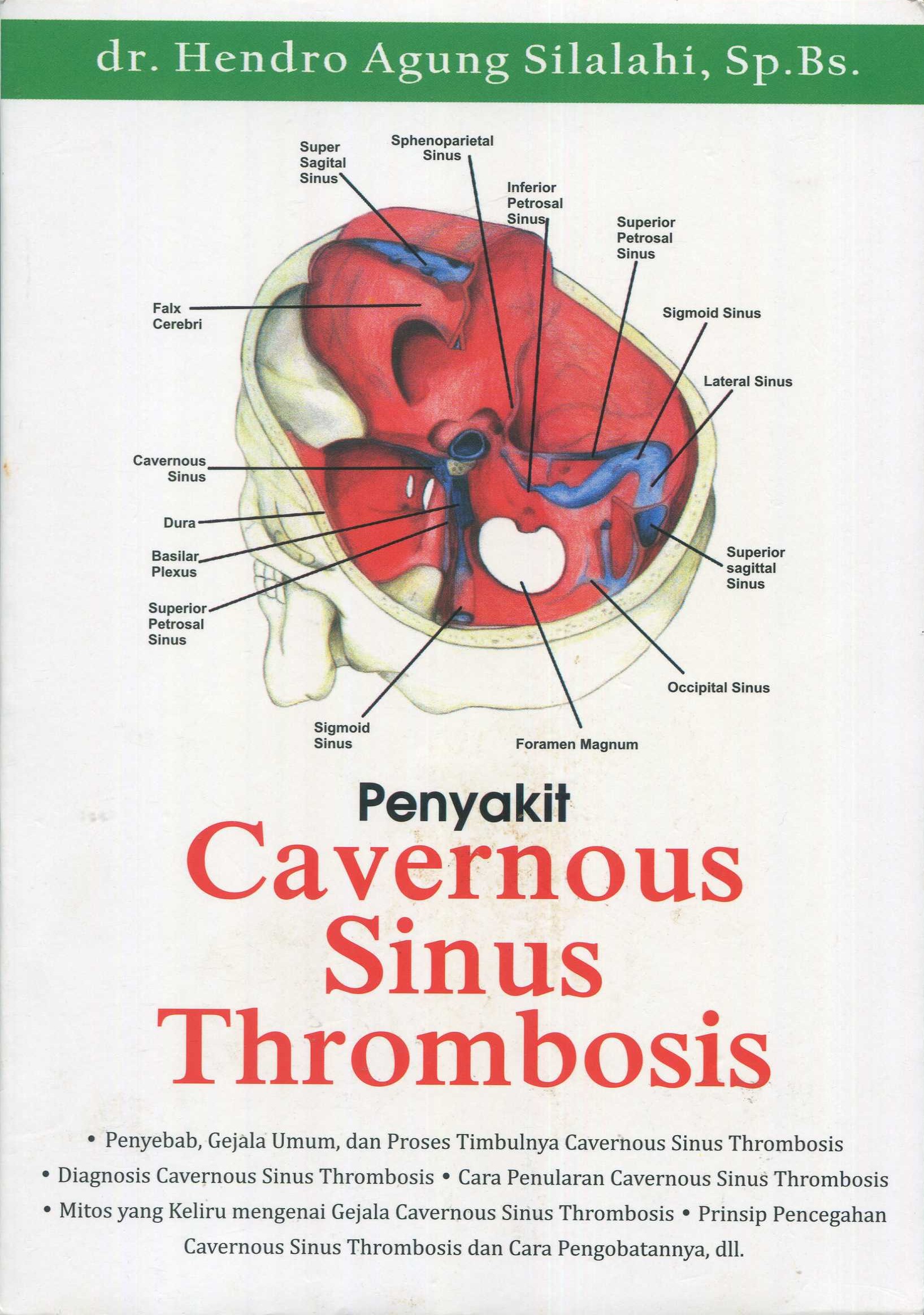 Cover Penyakit cavernous sinus thrombosis / dr. Hendro Agung Silalahi, Sp.Bs.; editor, Alessandro