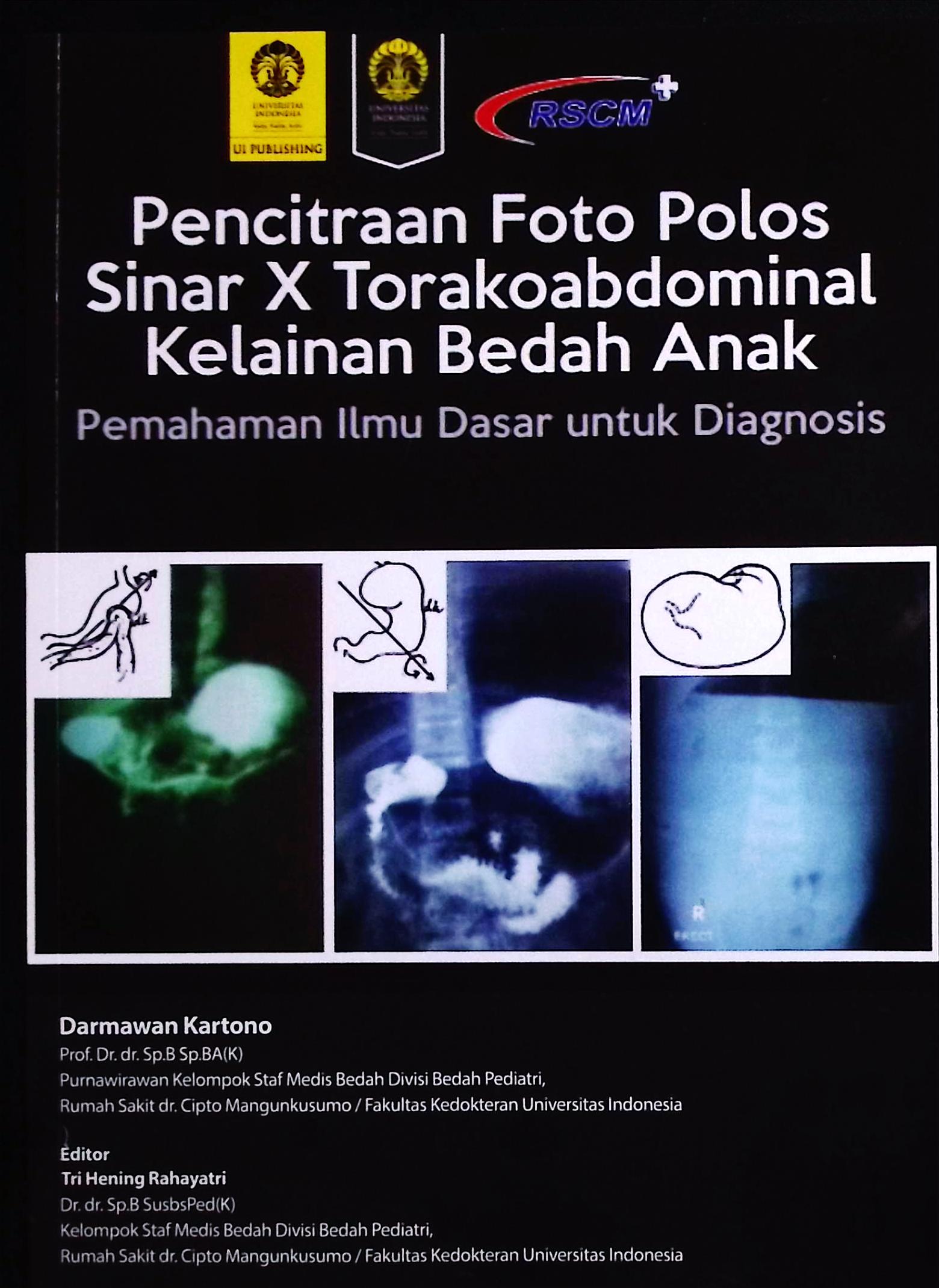 Cover Pencitraan foto polos sinar x torakoabdominal :  kelainan bedah anak / Prof. Dr. dr. Darmawan Kartono, Sp. B, Sp.BA(K); editor, Dr. dr. Tri Hening Rahayatri, Sp.B, Subsp.Ped(K)