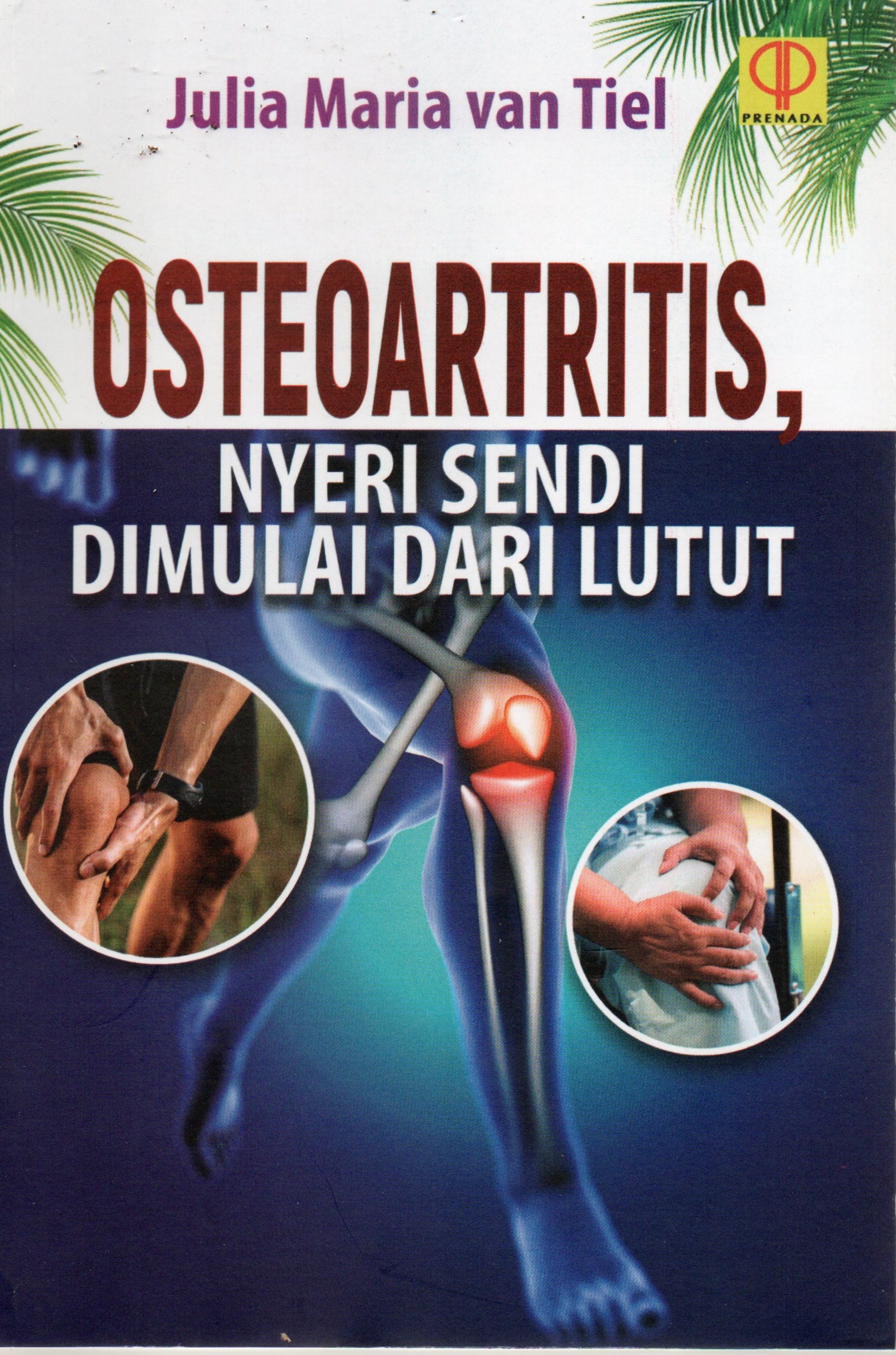 Cover Osteoartritis, Nyeri sendi dimulai dari lutut / Julia Maria Van Tiel