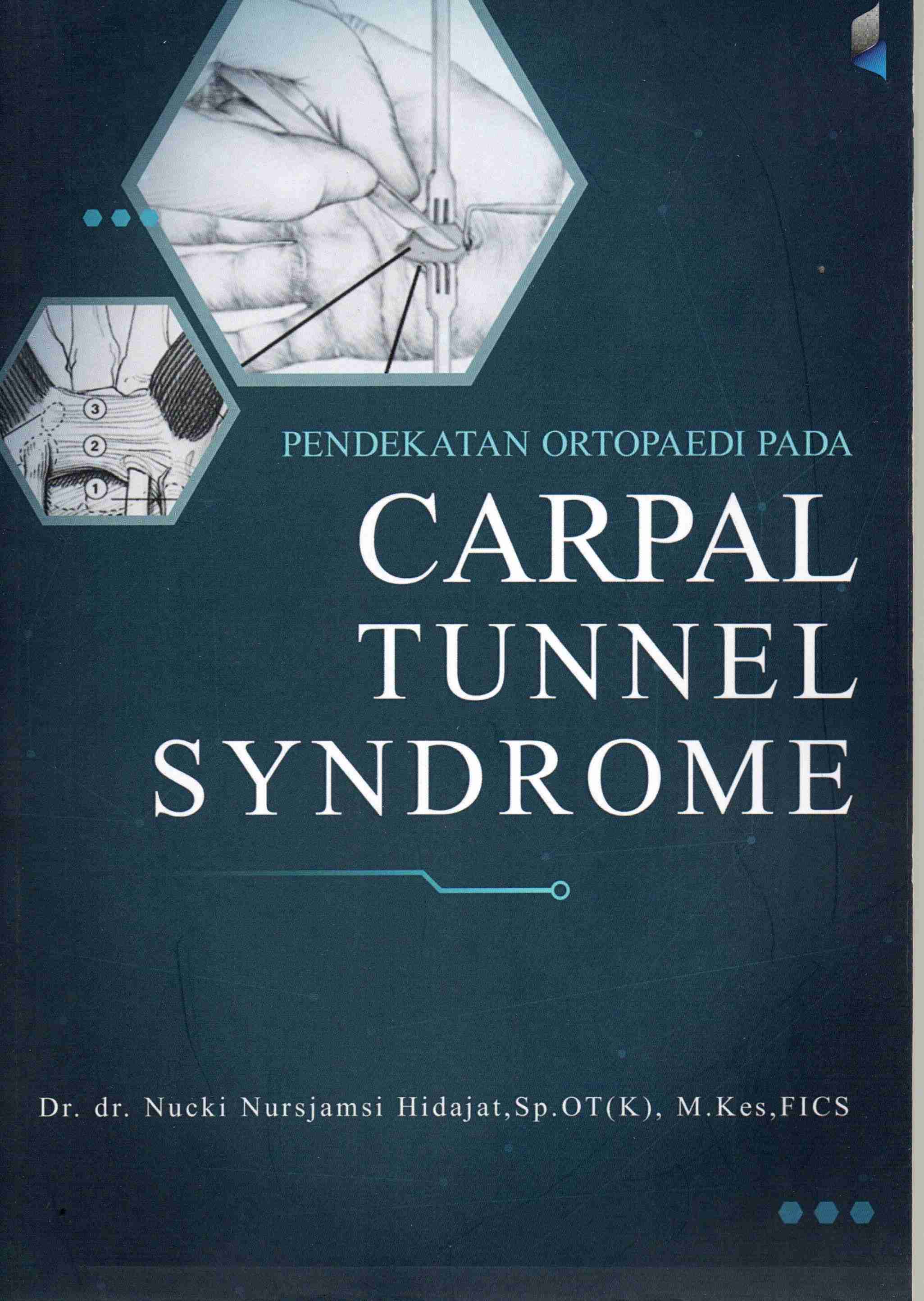 Cover Pendekatan ortopedi pada carpal tunnel syndrome Sindroma lorong karpal ) / Nucki Nursjamsi Hidajat