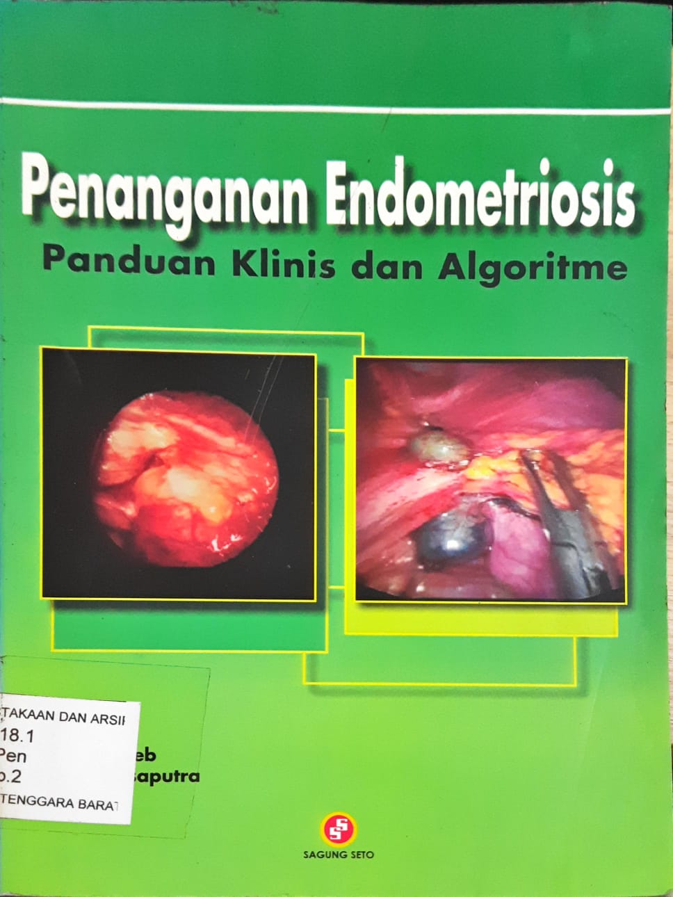 Cover Penanganan endometriosis : panduan klinis dan algoritme, / Penyunting, T.Z.Jacoeb, W.Hadisaputra