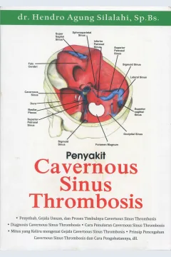 Cover Penyakit cavernous sinus thrombosis / dr. Hendro Agung Silalahi, Sp.Bs.; editor, Alessandro